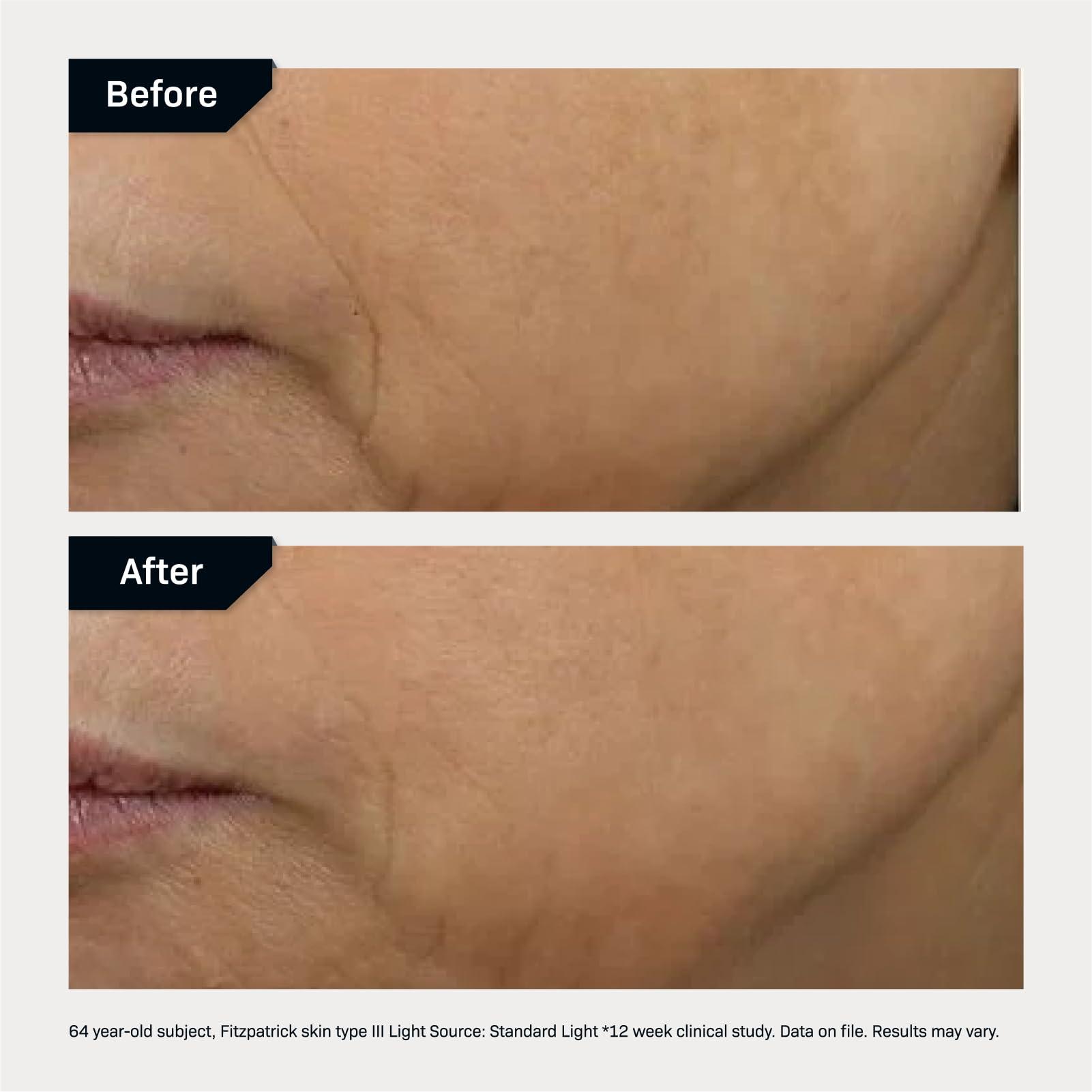 Revision Skincare D·E·J Face Cream®, Advanced Anti Aging Moisturizer, Lifting and Firming, Antioxidant Rich - Image 6