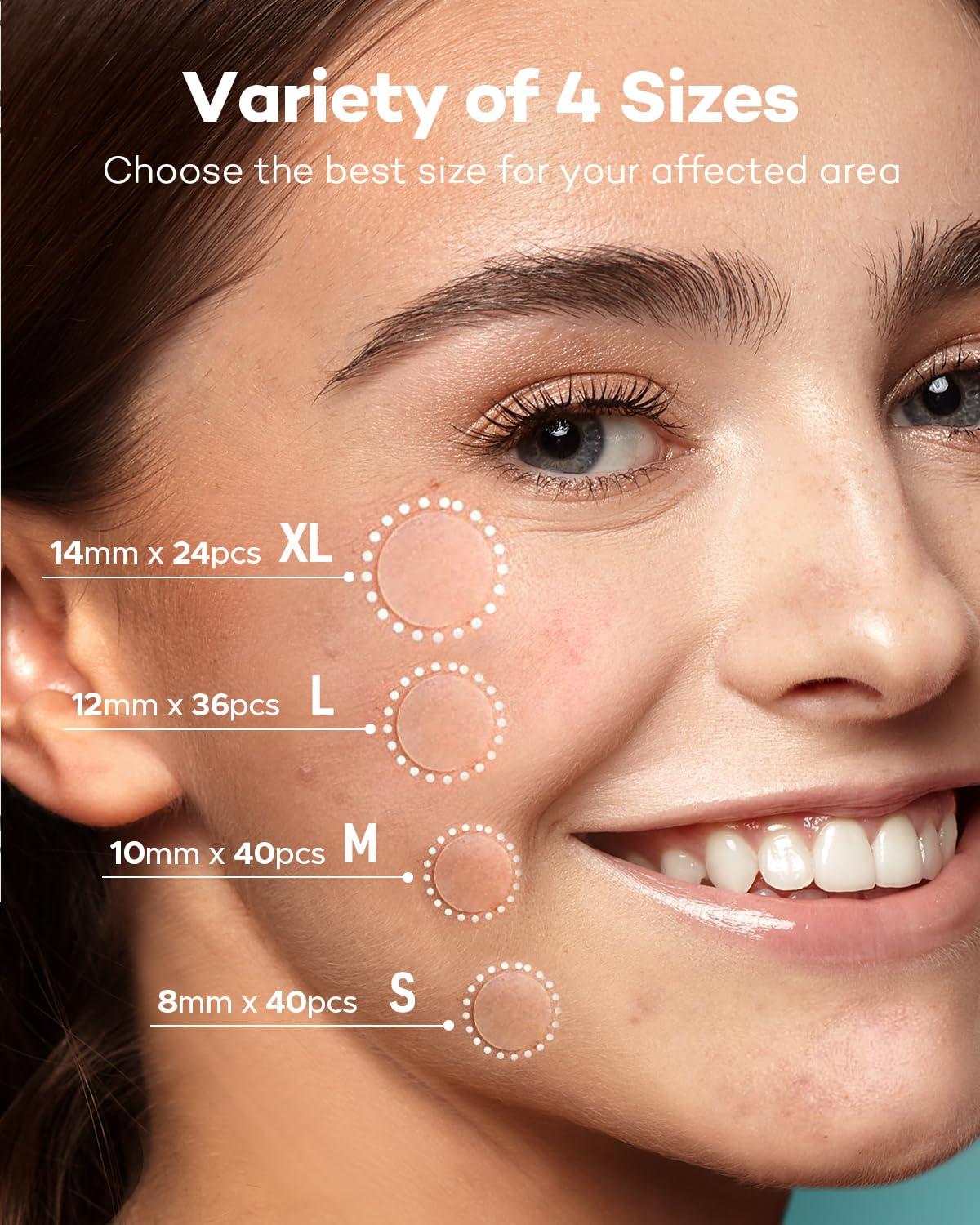 Pimple Patch Acne Patch, 4 Sizes 140 Patches Acne Absorbing Cover Patch, Hydrocolloid Invisible Acne Patches for Face Zit Patch Acne Dots Tea Tree, Calendula Oil - Image 2