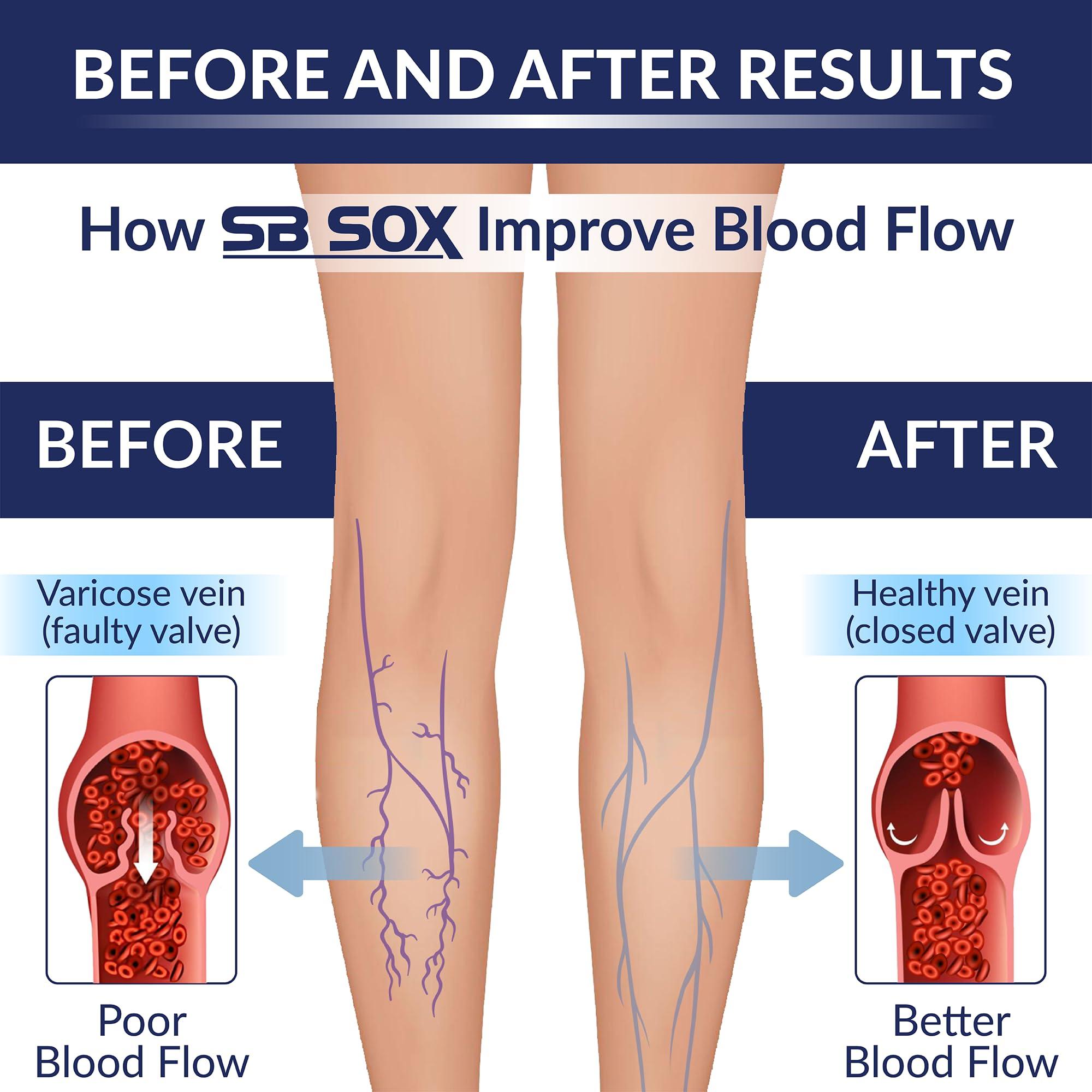 SB SOX Compression Socks for Men & Women (20-30 mmHg) - Best Support Stockings for Travel, Medical, and Sports - Perfect for Everyday Wear - Image 3