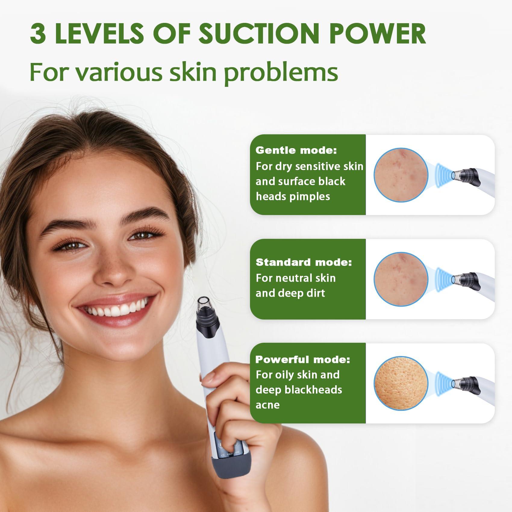Blackhead Remover Vacuum - Black Head Remover for Face,Blackhead Extractor Tool with 3 Adjustable Suction Levels,4 Probes,USB Interface Type Pore Vacuum,Suitable for Women and Men (White) - Image 2