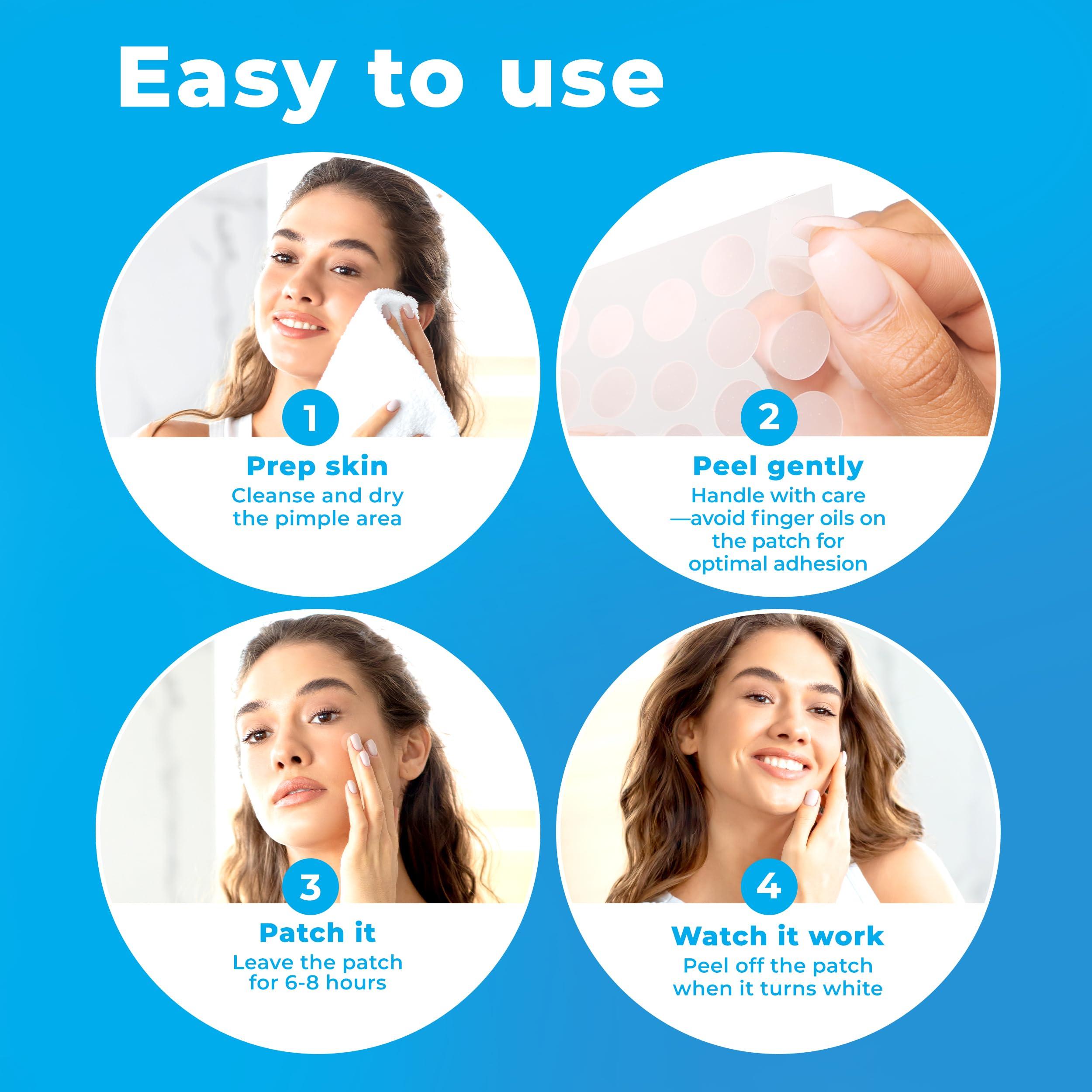 PatchRx Pimple Patches for Face (120 Patches), Hydrocolloid Acne Patches with Tea Tree Oil, Pimple Patch Pimple Stickers - Hydrocolloid Patch Acne Dots - Acne Pimple Patches For Face - Zit Patches - Image 7