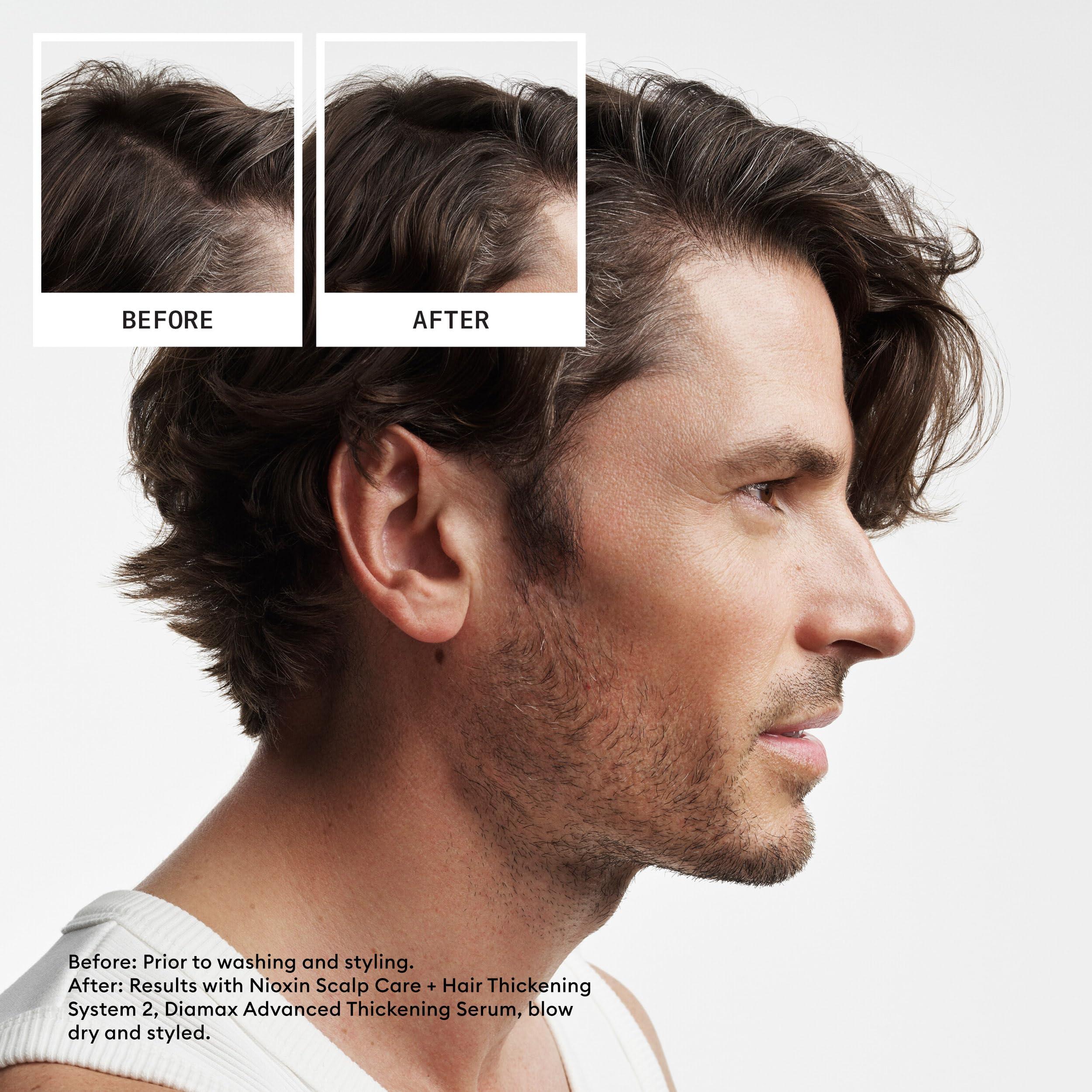Nioxin System 2 Scalp + Hair Thickening Shampoo For Natural Hair with Progressed Thinning Boost Hair Density with Niacinamide & Biotin - Image 3